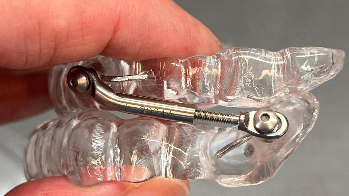Protrusionsschiene 2 bearbeitet 2026